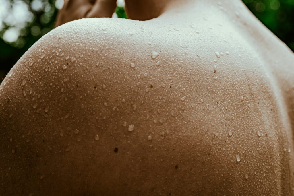 Excessive sweating